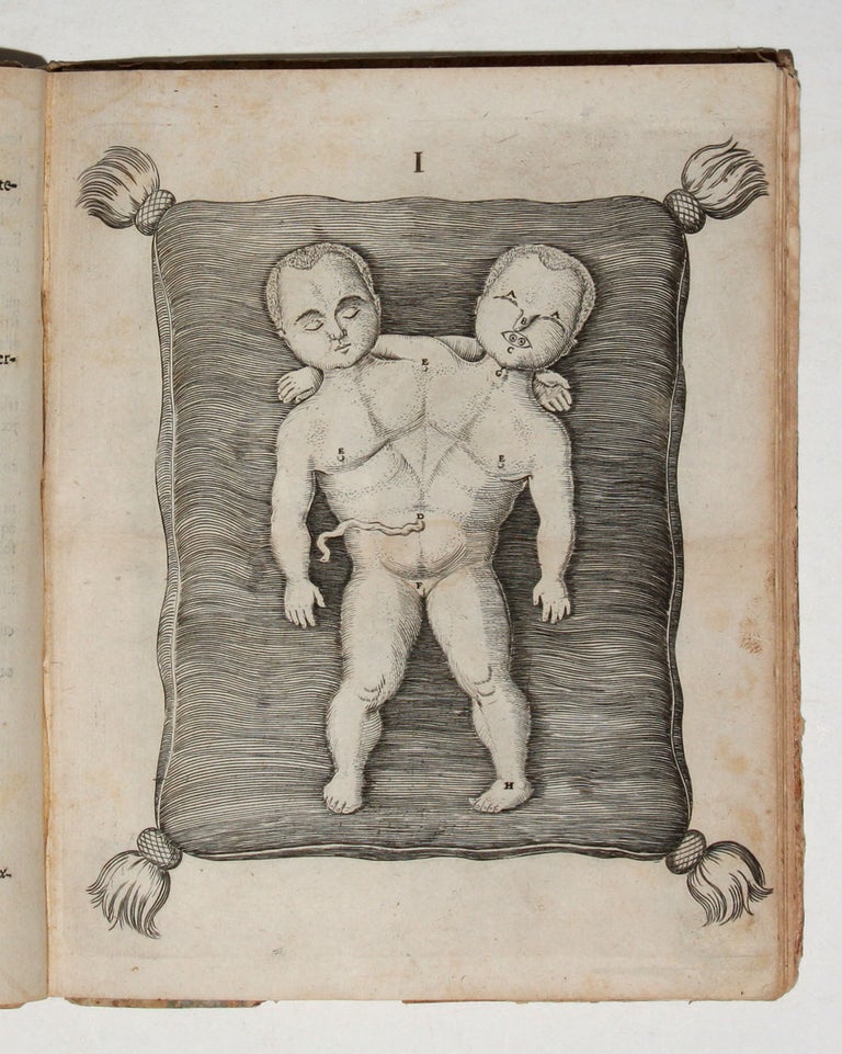 Item #4124 Specimina Anatomica, cum clarriss. Doctissimorumque Virorum Epistolis aliquot & Testimoniis. D. D. Ludovici de BILS.