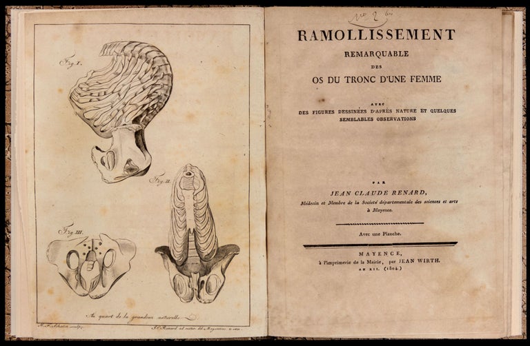 Item #4480 Ramollissement remarquable des os du tronc d’une femme, avec des figures dessinées d’après nature et quelques semblables observations. Jean Claude RENARD.